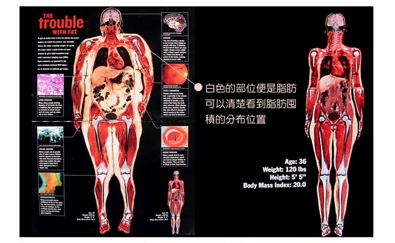 胖子與瘦子的脂肪量