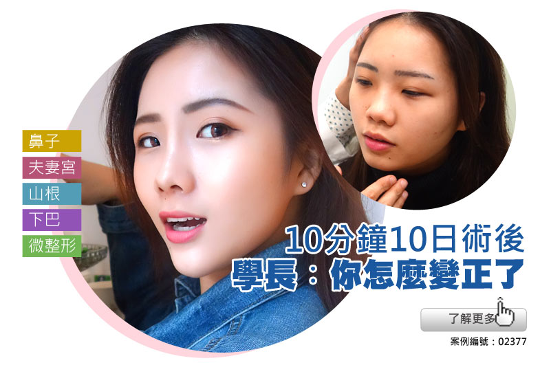 晶亮瓷 恆麗美型_蔡家碩_玻尿酸注射_玻尿酸推薦_玻尿酸台灣_台灣微整形推薦_玻尿酸價格_玻尿酸案例