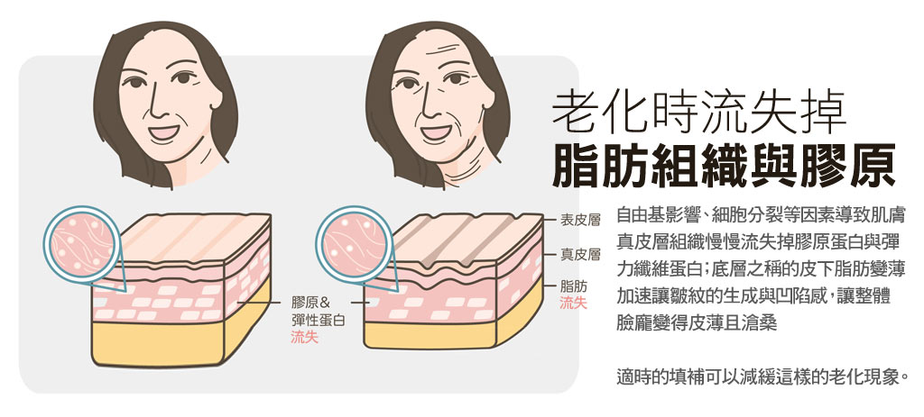 老化_彈力纖維膠原蛋白與皮下脂肪